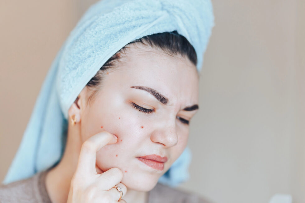 Hva er dermatillomani (hudplukking)?