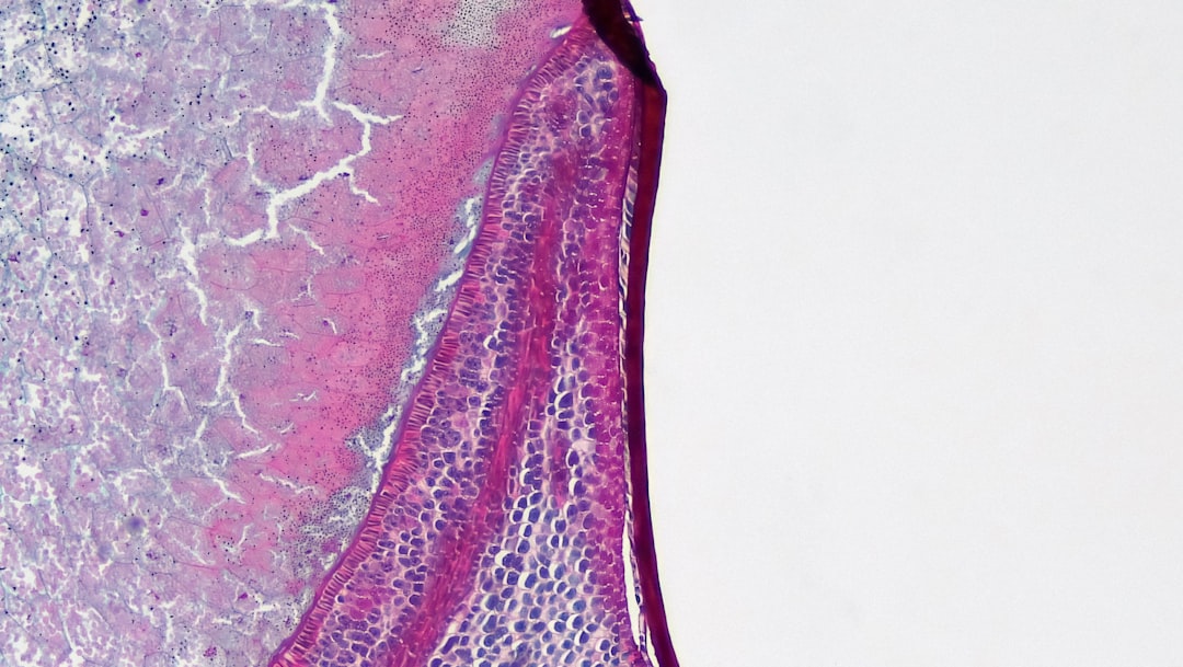 Lateral epikondylitt behandling